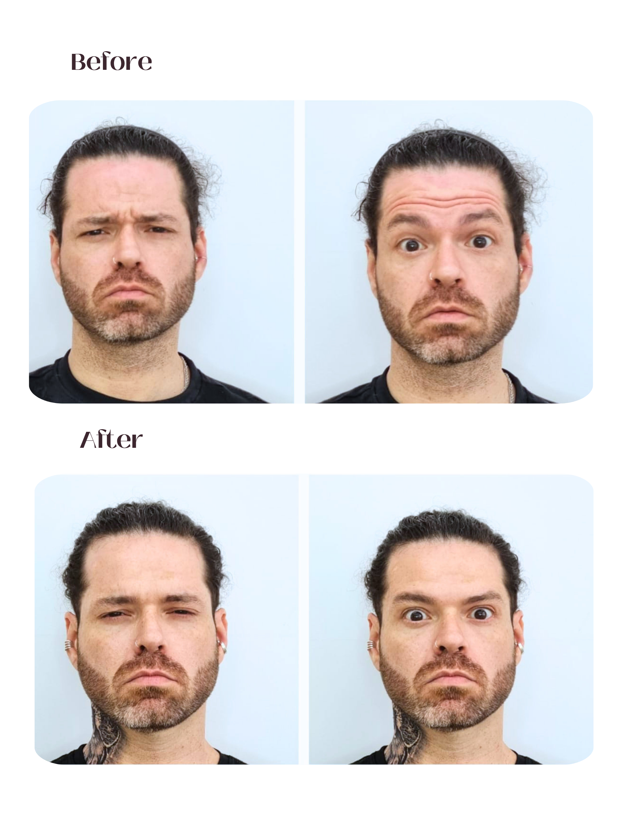 Masculina - Frente