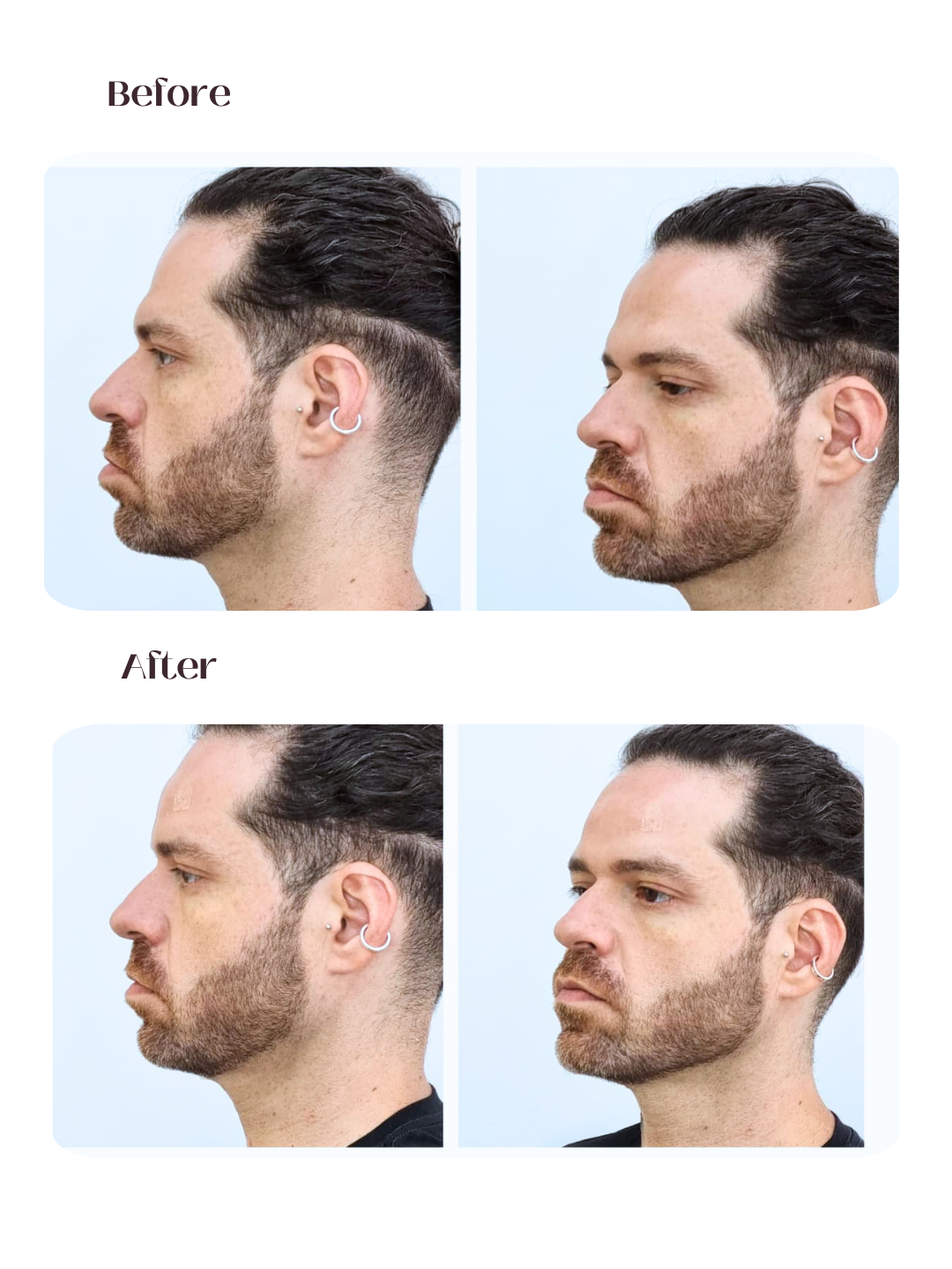 Masculina - Perfil